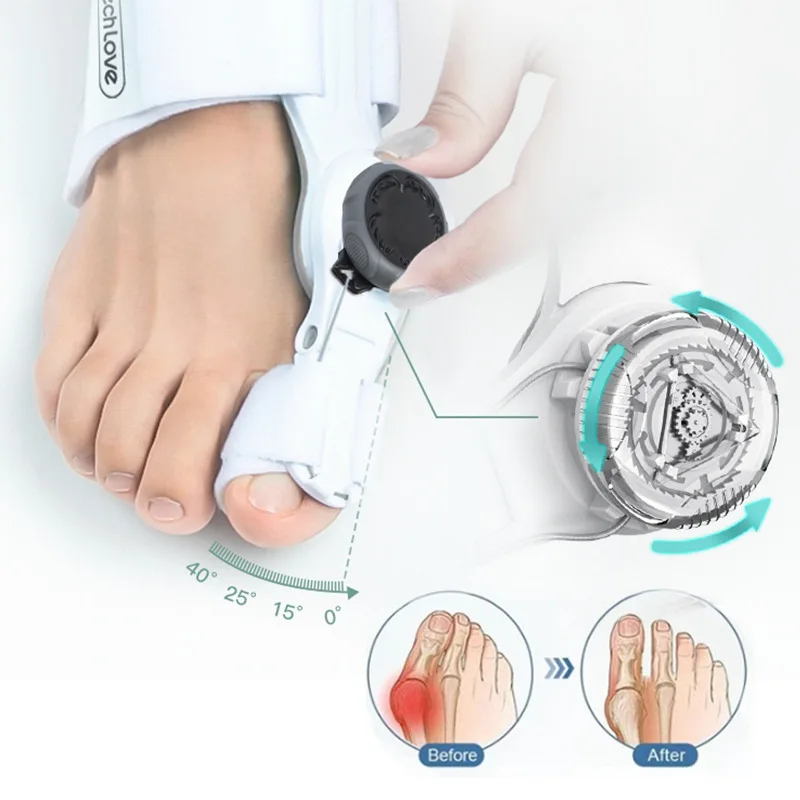 Customizable thumb valgus toe braces Adjustable
Customizable thumb valgus toe braces Adjustable