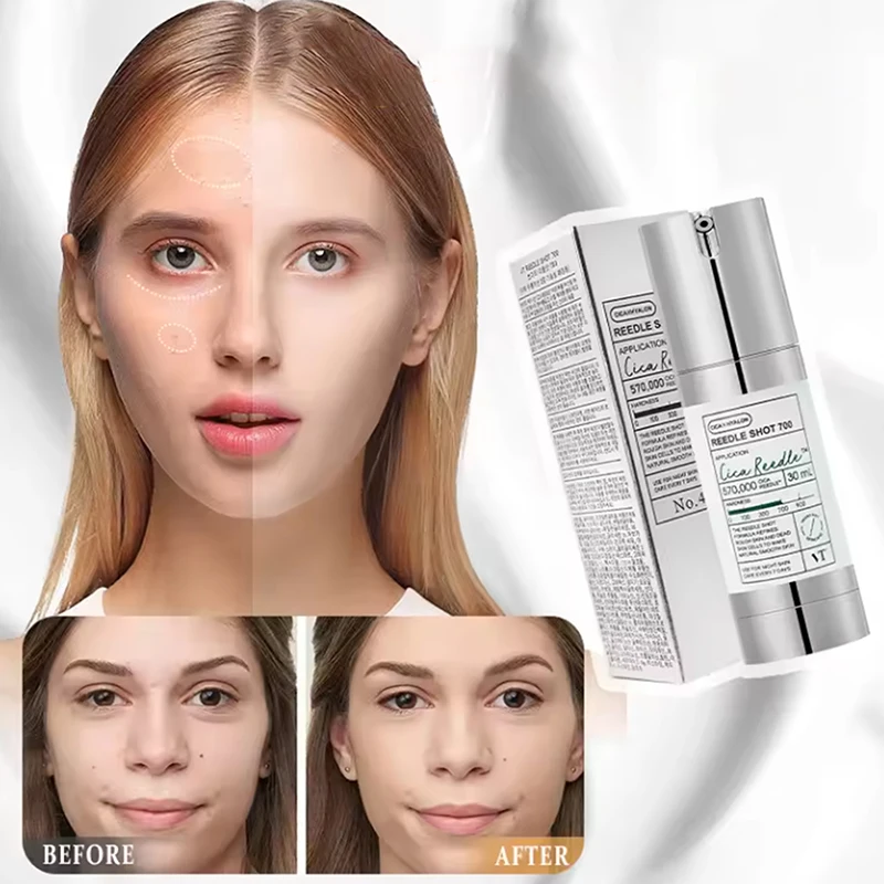 Fine Lines Moisturizing Skin Care Microneedle Serum Under0.3mm Moisturizing Lotion Correcting Facial Serum Firming Reduces
Fine Lines Moisturizing Skin Care Microneedle Serum Under0.3mm Moisturizing Lotion Correcting Facial Serum Firming Reduces