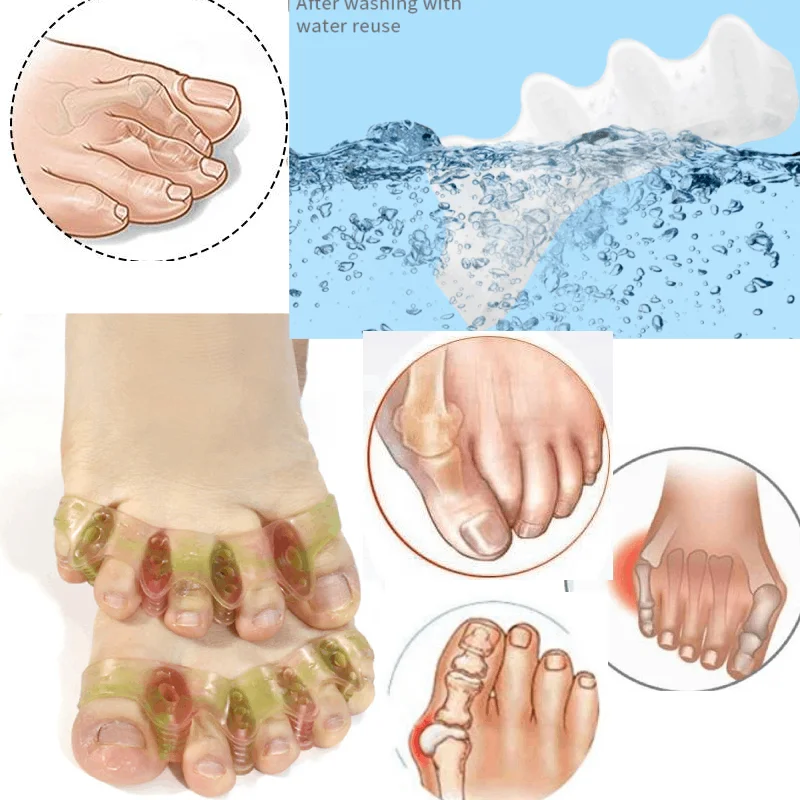 1/2/5Pairs Silicone Toe Separator,Bunion Corrector Toe Spacers to Correct Bunions Toe Straightener Stretcher Gel Toe Protector
1/2/5Pairs Silicone Toe Separator,Bunion Corrector Toe Spacers to Correct Bunions Toe Straightener Stretcher Gel Toe Protector