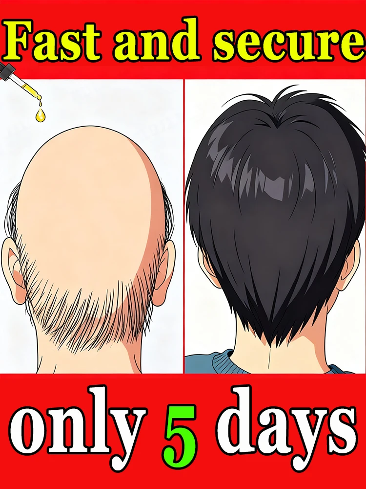 #2 Bestseller. Say goodbye to hair loss and baldness in just 7 days. New arrival.
#2 Bestseller. Say goodbye to hair loss and baldness in just 7 days. New arrival.