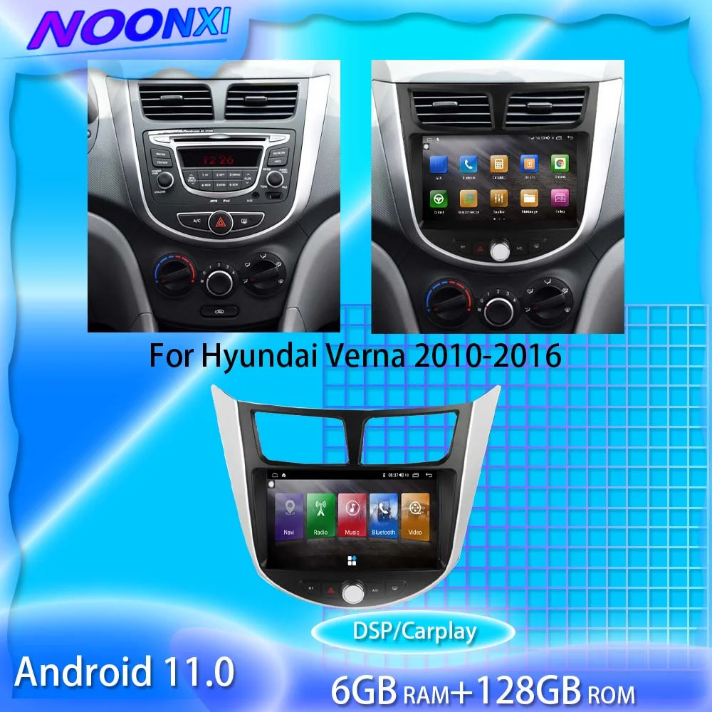 Автомагнитола для Hyundai Verna 2010, 2011, 2012-2016, Android 128, ГГц, 2Din, мультимедийный плеер, GPS-навигация, сенсорный экран
Автомагнитола для Hyundai Verna 2010, 2011, 2012-2016, Android 128, ГГц, 2Din, мультимедийный плеер, GPS-навигация, сенсорный экран