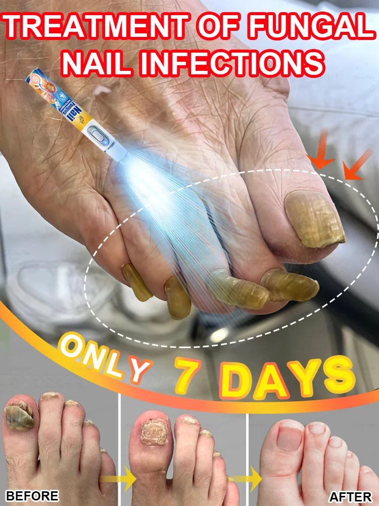 Holiday offers, nail kits
Holiday offers, nail kits