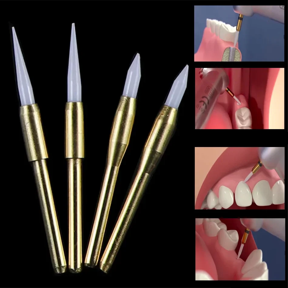Dental Soft Tissue Repairing Car Needle Gingival Trimming High-speed Ceramic Car Needle High-frequency Hard Tissue Resection
Dental Soft Tissue Repairing Car Needle Gingival Trimming High-speed Ceramic Car Needle High-frequency Hard Tissue Resection