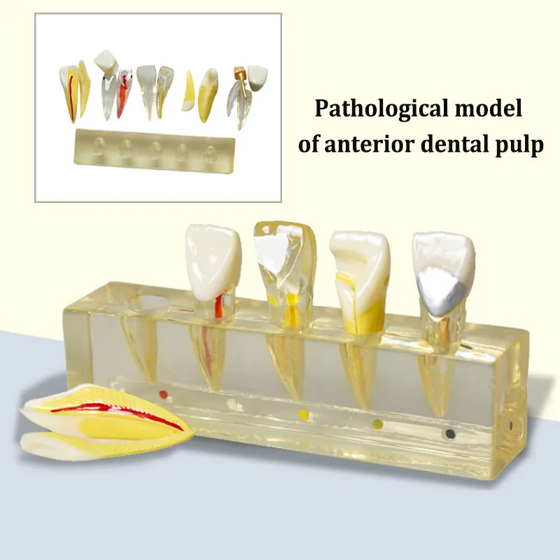 Oral Model Tooth Model Dental Model Teaching Detachable Pathological Model Dentistry Orthodontics Teaching Utensils
Oral Model Tooth Model Dental Model Teaching Detachable Pathological Model Dentistry Orthodontics Teaching Utensils