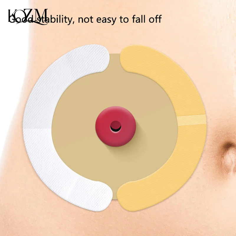 20 шт./кор. эластичные полоски для стомы, гидроколлоидные водонепроницаемые клейкие ленты для утечки кожи, барьерная лента для стомы, сумка для колостомы
20 шт./кор. эластичные полоски для стомы, гидроколлоидные водонепроницаемые клейкие ленты для утечки кожи, барьерная лента для стомы, сумка для колостомы