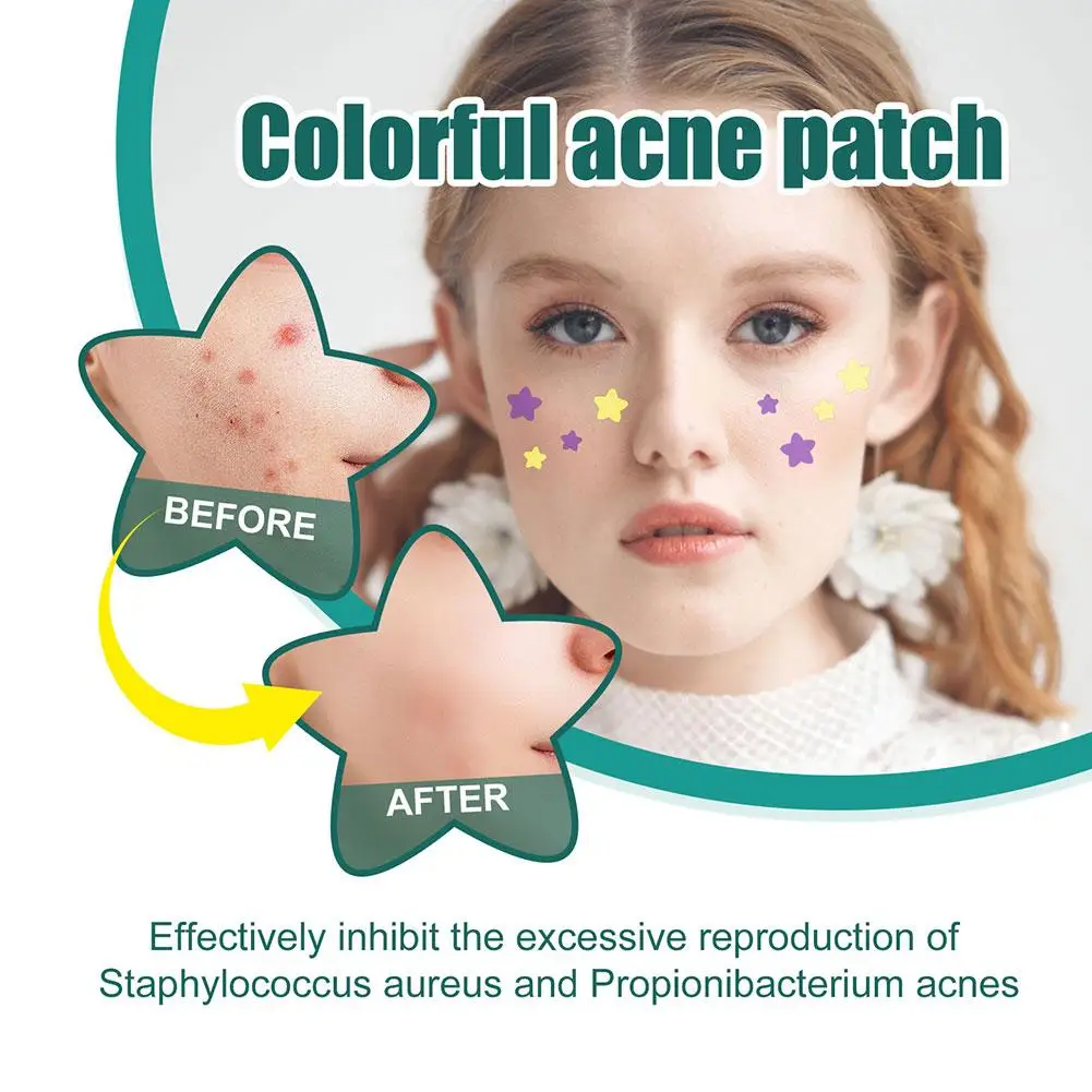  280/1120/1680pcs Star-Shaped Acne Care Patches Hydrocolloid Spot Stickers Absorbing Pimple Patches for Blemishes
280/1120/1680pcs Star-Shaped Acne Care Patches Hydrocolloid Spot Stickers Absorbing Pimple Patches for Blemishes