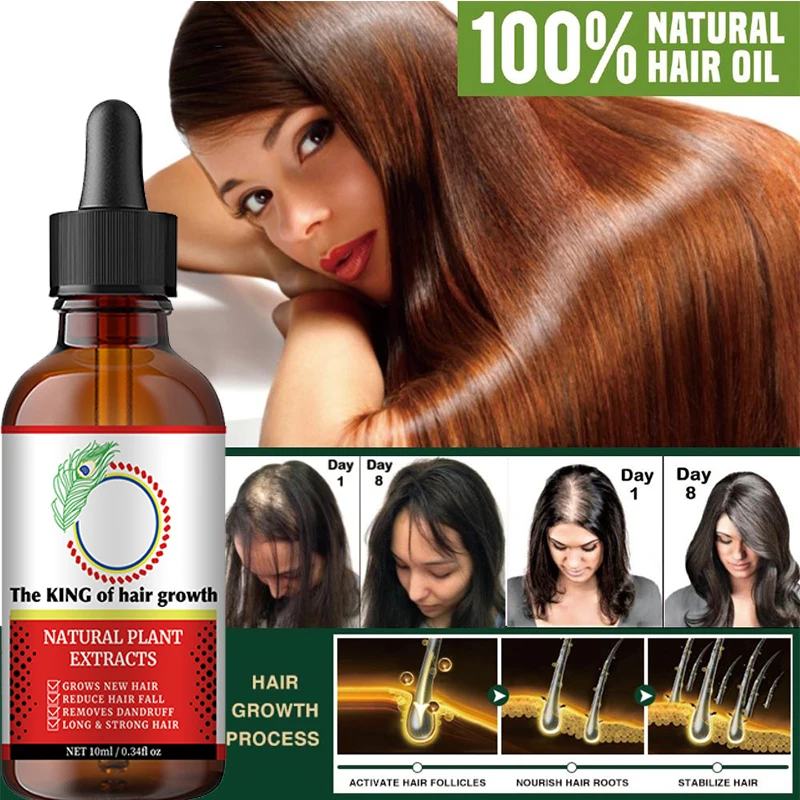 Fast Hair Growth Oil Baldness Repair Hereditary Hair Loss Postpartum Hair Loss Seborrheic Hair Loss Hair Oil Fast Hair Growth
Fast Hair Growth Oil Baldness Repair Hereditary Hair Loss Postpartum Hair Loss Seborrheic Hair Loss Hair Oil Fast Hair Growth