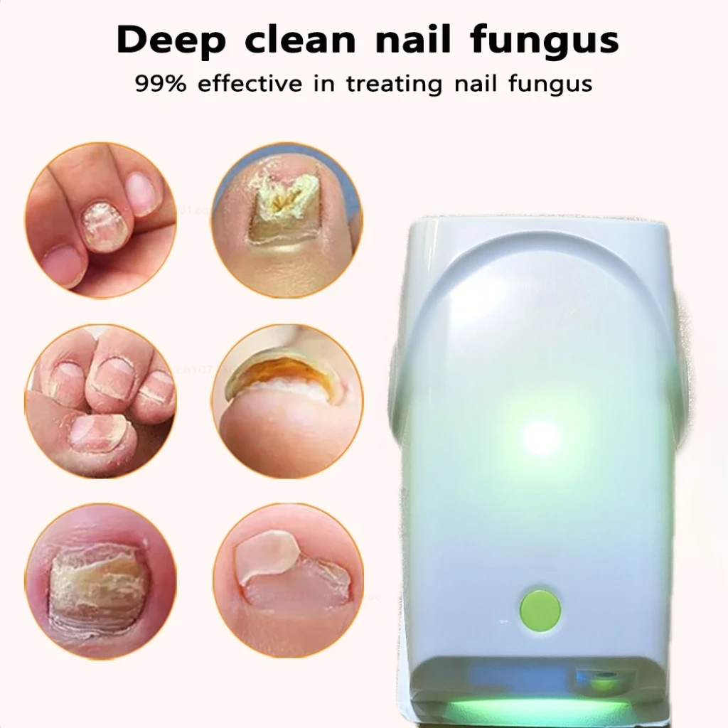 905nm Nail Fungus Laser Nail Repair Foot Nail Fungus Removal Anti Infection Paronychia Onychomycosis Care Instrument
905nm Nail Fungus Laser Nail Repair Foot Nail Fungus Removal Anti Infection Paronychia Onychomycosis Care Instrument