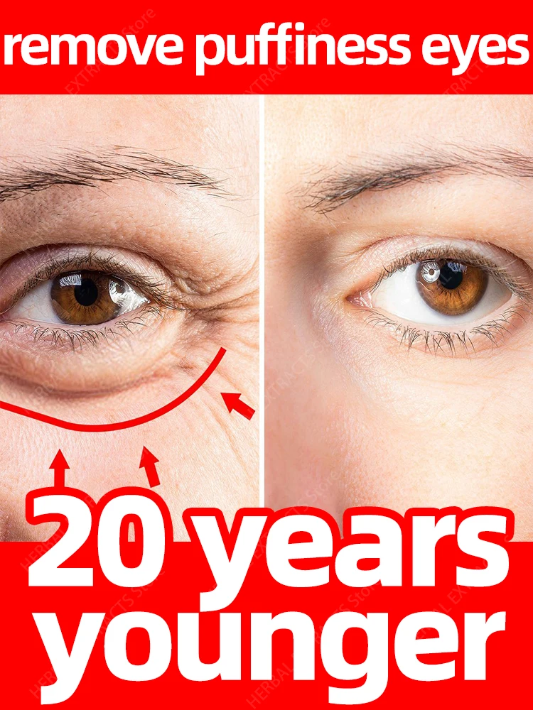 Cëlyn 3 Minutes Firm Eye Cream Lifting Tighten Alleviate Eye Bags Dark Circles Moisturize Peptide Eye Cream
Cëlyn 3 Minutes Firm Eye Cream Lifting Tighten Alleviate Eye Bags Dark Circles Moisturize Peptide Eye Cream