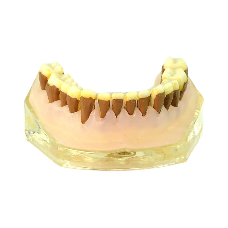 Periodontitis Teeth Model Dental Teeth Model Dental Demonstration Model Dental Teaching Instrument
Periodontitis Teeth Model Dental Teeth Model Dental Demonstration Model Dental Teaching Instrument