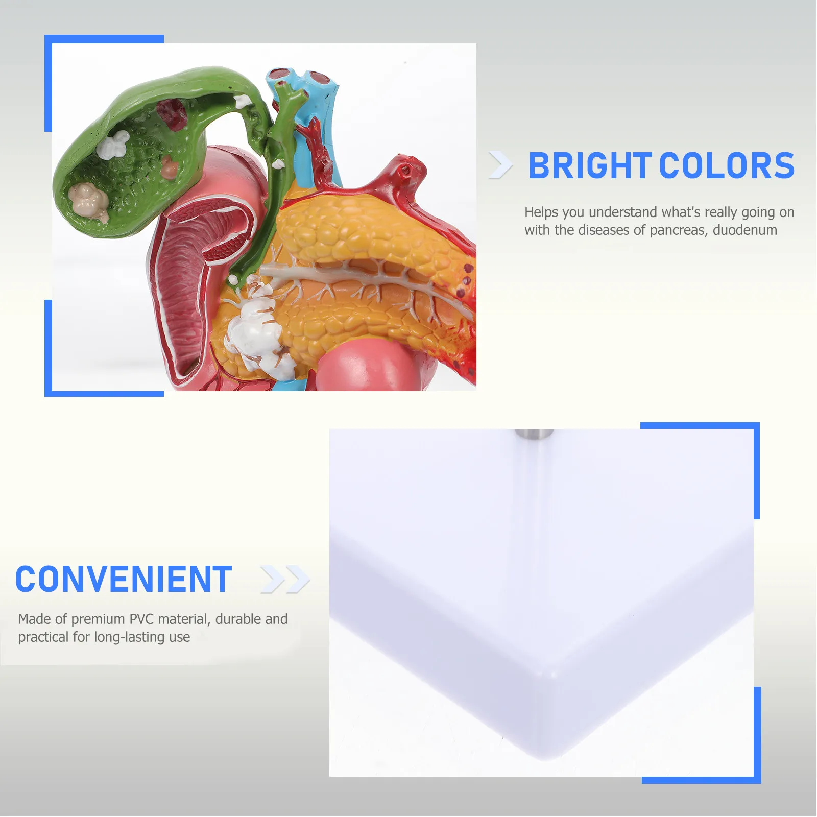 Human Pancreas Gallbladder Duodenal Pathological Teaching Instrument Realistic Anatomy Biological Science Display for Teaching
Human Pancreas Gallbladder Duodenal Pathological Teaching Instrument Realistic Anatomy Biological Science Display for Teaching