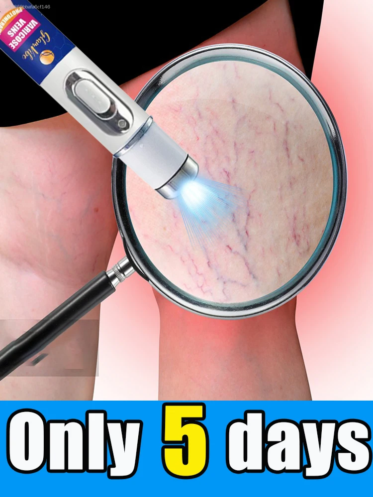 Spreading from legs, feet, arms, and hands
Spreading from legs, feet, arms, and hands