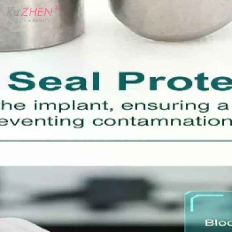 Dental Implant Accessory For Dentium Composite Protective Cap Immediate Load-bearing Implant Substitute Transfer RodClosingScrew
Dental Implant Accessory For Dentium Composite Protective Cap Immediate Load-bearing Implant Substitute Transfer RodClosingScrew