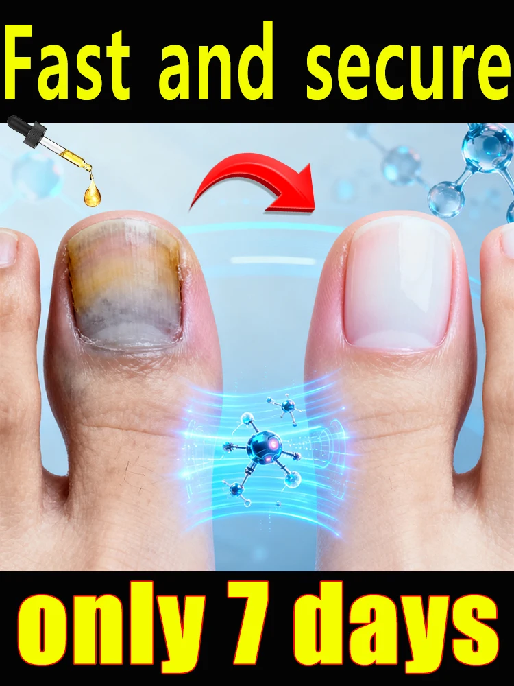 Самый эффективный продукт для удаления грибка ногтей 2025 года, восстановление здоровых ногтей за 7 дней, постоянный эффект.
Самый эффективный продукт для удаления грибка ногтей 2025 года, восстановление здоровых ногтей за 7 дней, постоянный эффект.
