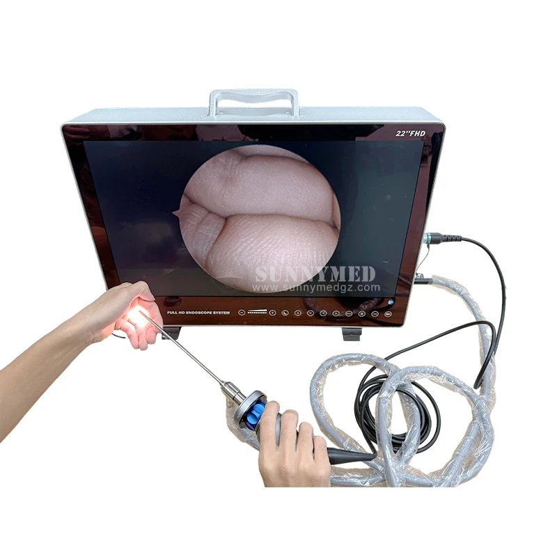 SY-P3910_4 175mm Rigid Sinuscope Endoscope ENT Surgical Instrument for Nose Eyes Throat and Ear Surgery
SY-P3910_4 175mm Rigid Sinuscope Endoscope ENT Surgical Instrument for Nose Eyes Throat and Ear Surgery