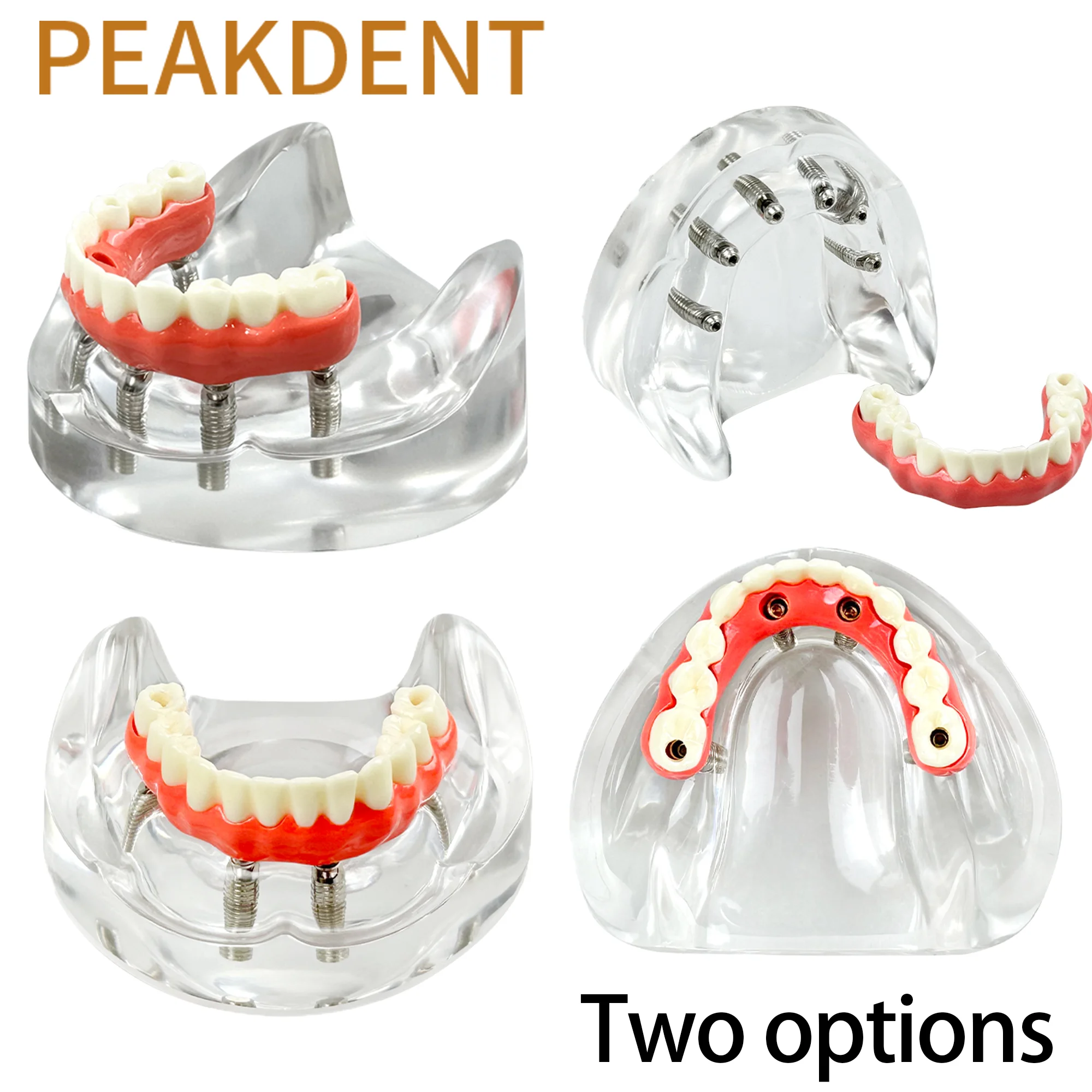Dental Implant Model Overdenture Teeth Removable Implant Model Dentist Student Education Typodont Implant Research Model
Dental Implant Model Overdenture Teeth Removable Implant Model Dentist Student Education Typodont Implant Research Model