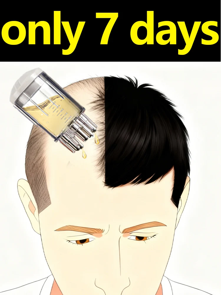 Новинка 2025 года, массажная жидкость с роликовым шариком, расческа для волос с эссенцией для быстрого нанесения роста волос
Новинка 2025 года, массажная жидкость с роликовым шариком, расческа для волос с эссенцией для быстрого нанесения роста волос