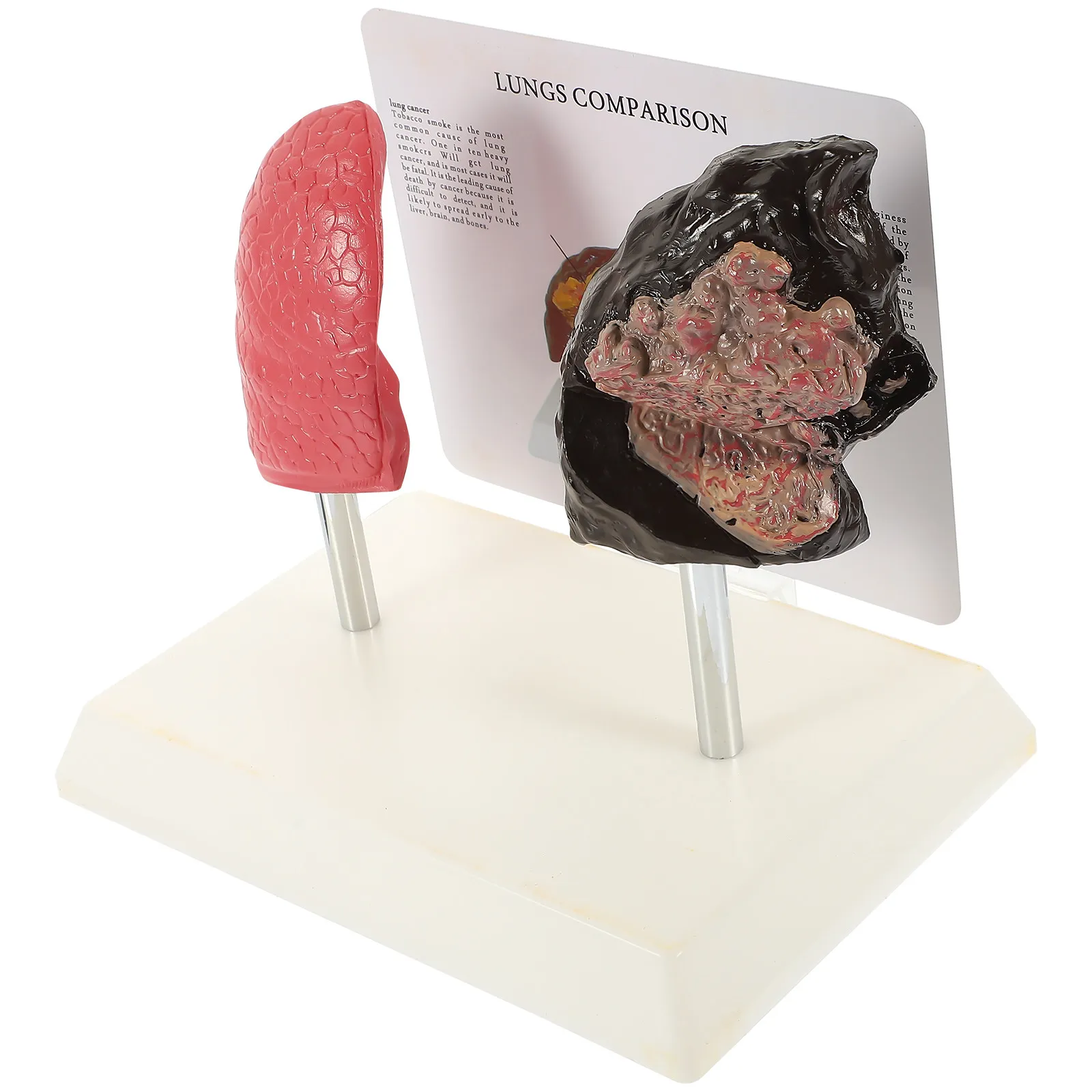 1Pcs Detailed Smoking Lung Comparison Respiratory Lung Anatomy Teaching for School Nursing Education
1Pcs Detailed Smoking Lung Comparison Respiratory Lung Anatomy Teaching for School Nursing Education