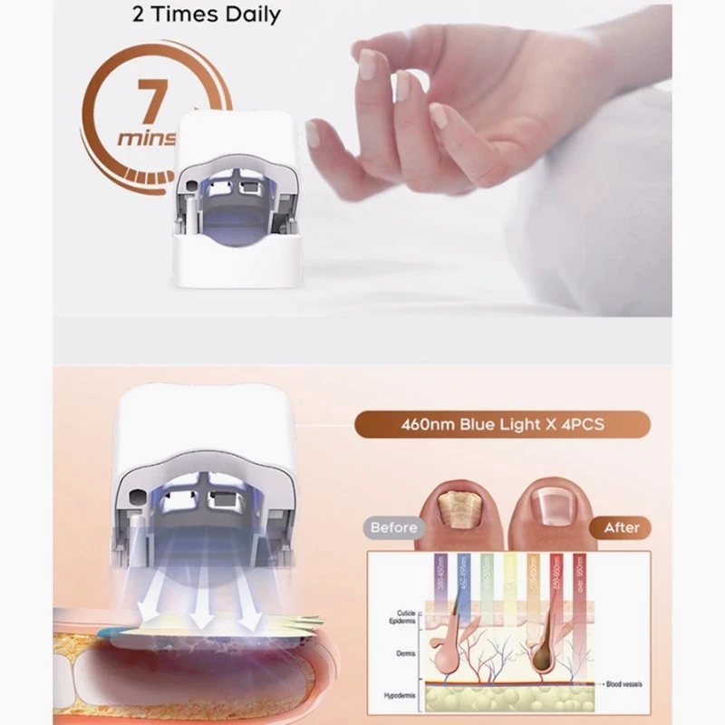 AW-AA20-Nail Fungu Cleaning Light With LED Display Device Nail Fungu Treatments For Onychomycosis Light For Finger/Toenails
AW-AA20-Nail Fungu Cleaning Light With LED Display Device Nail Fungu Treatments For Onychomycosis Light For Finger/Toenails