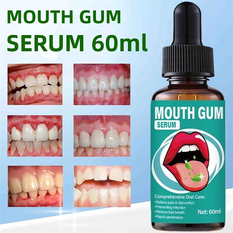 Rapid Repair Gums Serum Effectively Relieve Tooth Allergy Dental Caries Tooth Cleaning Toothpaste Relieve Tooth Damage Drops
Rapid Repair Gums Serum Effectively Relieve Tooth Allergy Dental Caries Tooth Cleaning Toothpaste Relieve Tooth Damage Drops