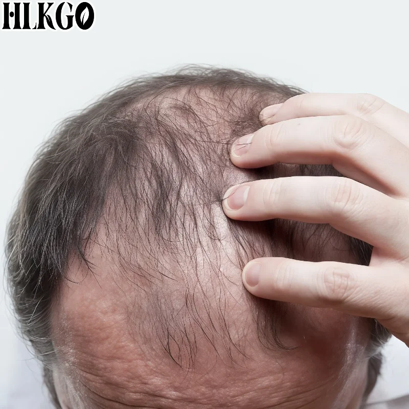 Медицинская лазерная шапка Clinical 90 с 210 светодиодами для восстановления роста волос, 6750 мВт, высокая мощность, настраиваемая, для ухода за кожей головы при андрогенетической алопеции
Медицинская лазерная шапка Clinical 90 с 210 светодиодами для восстановления роста волос, 6750 мВт, высокая мощность, настраиваемая, для ухода за кожей головы при андрогенетической алопеции