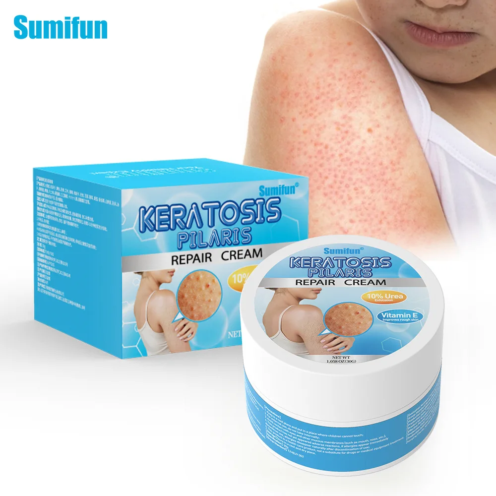 Крем для куриной кожи с витамином Е, отшелушивающий мочевина, прыщи K20069
Крем для куриной кожи с витамином Е, отшелушивающий мочевина, прыщи K20069