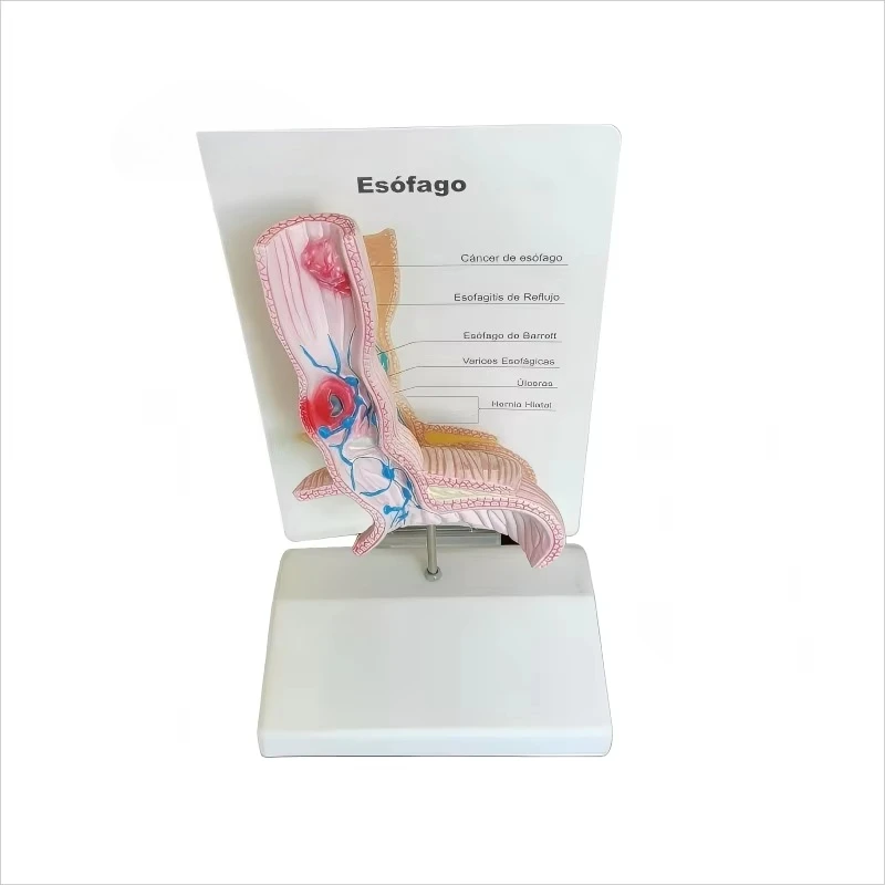 Medical Teaching Esophageal Anatomy Model Clinical Training