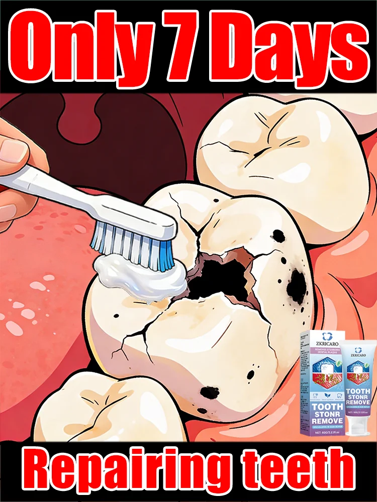 Pʀᴇᴠᴇɴᴛ ᴄᴀᴠɪᴛɪᴇs ᴀɴᴅ ᴘʀᴏᴛᴇᴄᴛ ʏᴏᴜʀ ᴛᴇᴇᴛʜ; sᴀʏ ɢᴏᴏᴅʙʏᴇ ᴛᴏ ᴛᴏᴏᴛʜ ᴅᴇᴄᴀʏ.decay
Pʀᴇᴠᴇɴᴛ ᴄᴀᴠɪᴛɪᴇs ᴀɴᴅ ᴘʀᴏᴛᴇᴄᴛ ʏᴏᴜʀ ᴛᴇᴇᴛʜ; sᴀʏ ɢᴏᴏᴅʙʏᴇ ᴛᴏ ᴛᴏᴏᴛʜ ᴅᴇᴄᴀʏ.decay