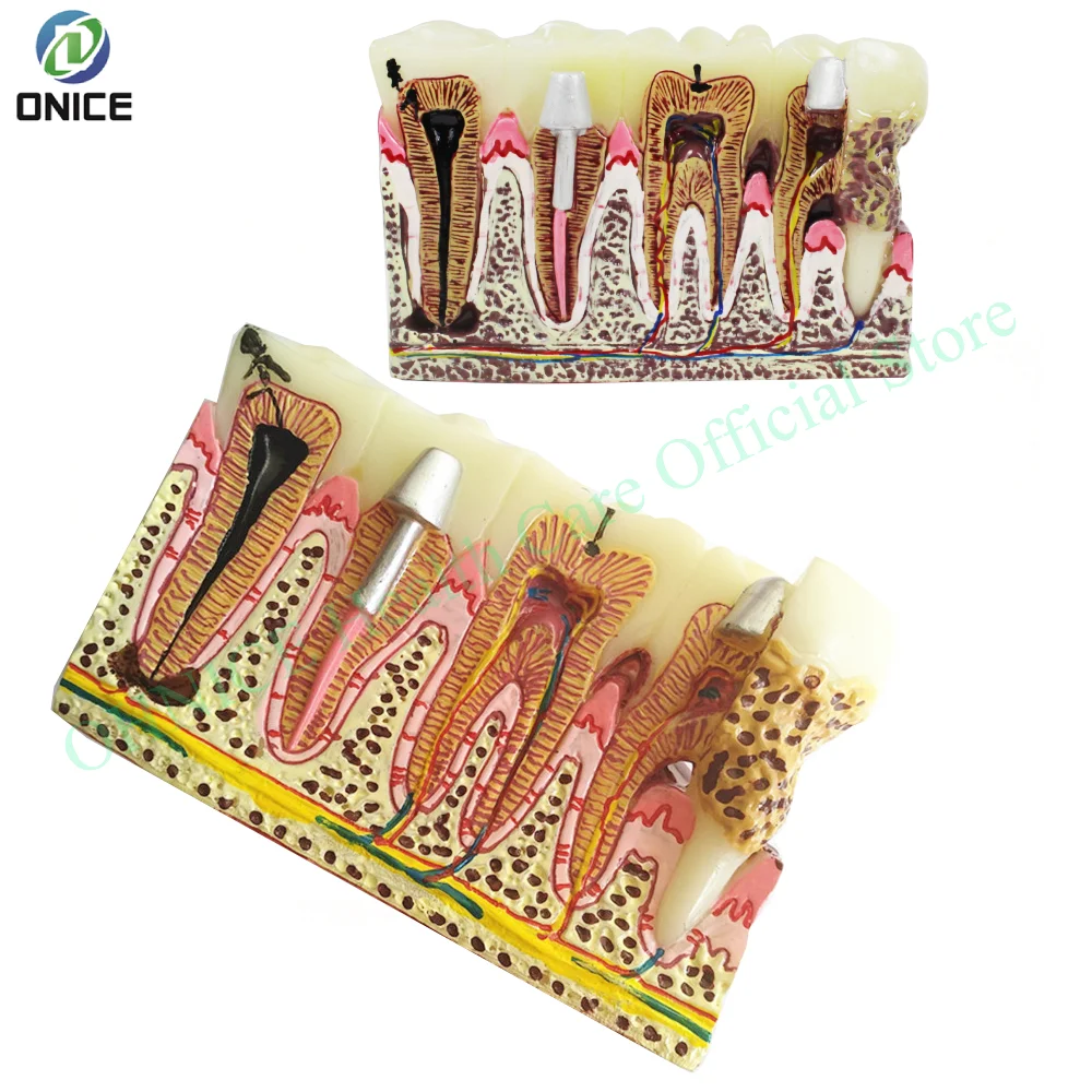 High-Fidelity Human Dental Disease Model: Demonstrating Pathological Conditions in Teeth & Gums for Clinical Teaching& Practice
High-Fidelity Human Dental Disease Model: Demonstrating Pathological Conditions in Teeth & Gums for Clinical Teaching& Practice