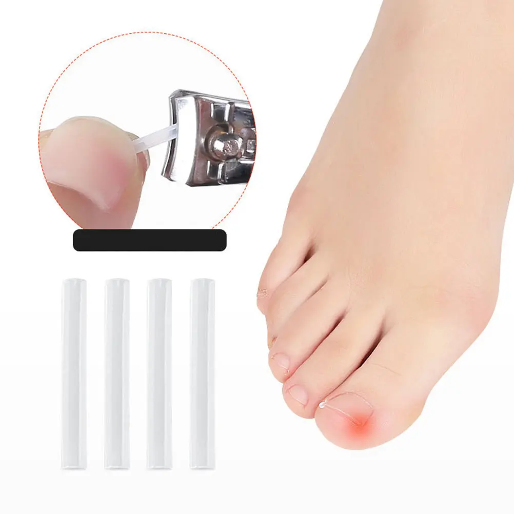 60Pcs Ingrown Toenail Corrector Strips Professional Toenail Correction Patches Home Pedicure Tool Ingrown Nail Treatment
60Pcs Ingrown Toenail Corrector Strips Professional Toenail Correction Patches Home Pedicure Tool Ingrown Nail Treatment