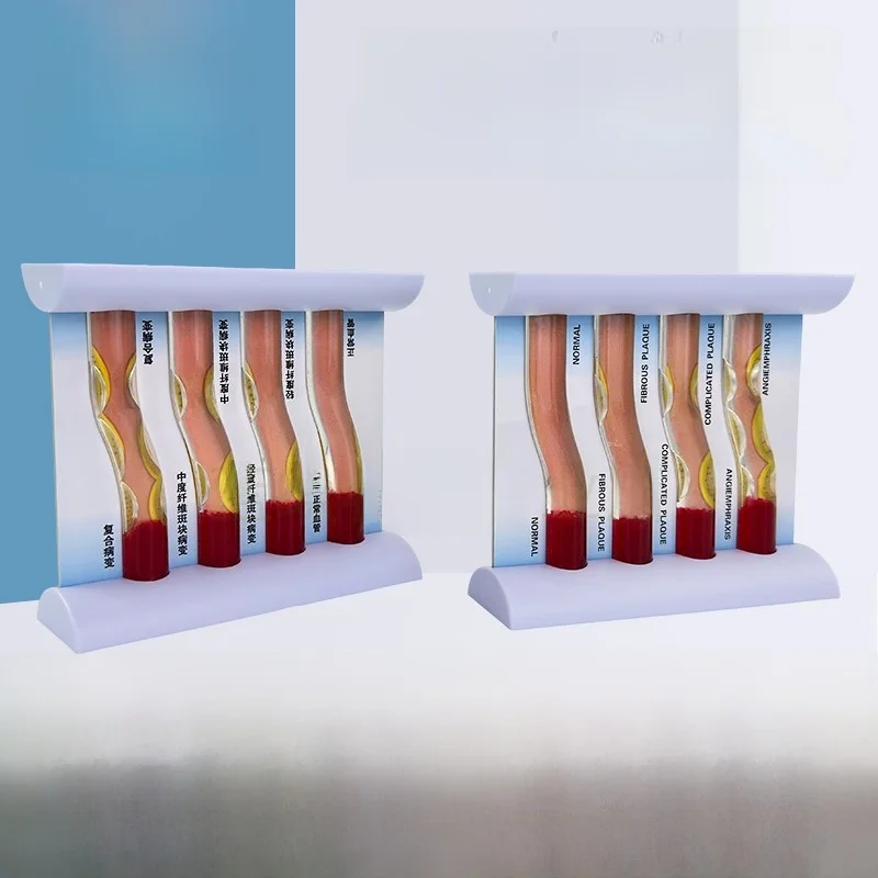 Blue Model Dync High Lipid Blood Viscosi Bloage Carison Model Four Arteries Teach Tool Static Model Toy
Blue Model Dync High Lipid Blood Viscosi Bloage Carison Model Four Arteries Teach Tool Static Model Toy