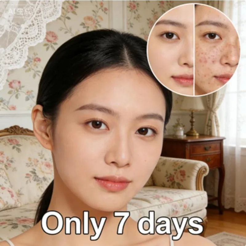 Ограниченное время захвата! Быстро устраняет прыщи, покраснение, отеки и склонную кожу от прыщей после освежает и безупречное лицо
Ограниченное время захвата! Быстро устраняет прыщи, покраснение, отеки и склонную кожу от прыщей после освежает и безупречное лицо