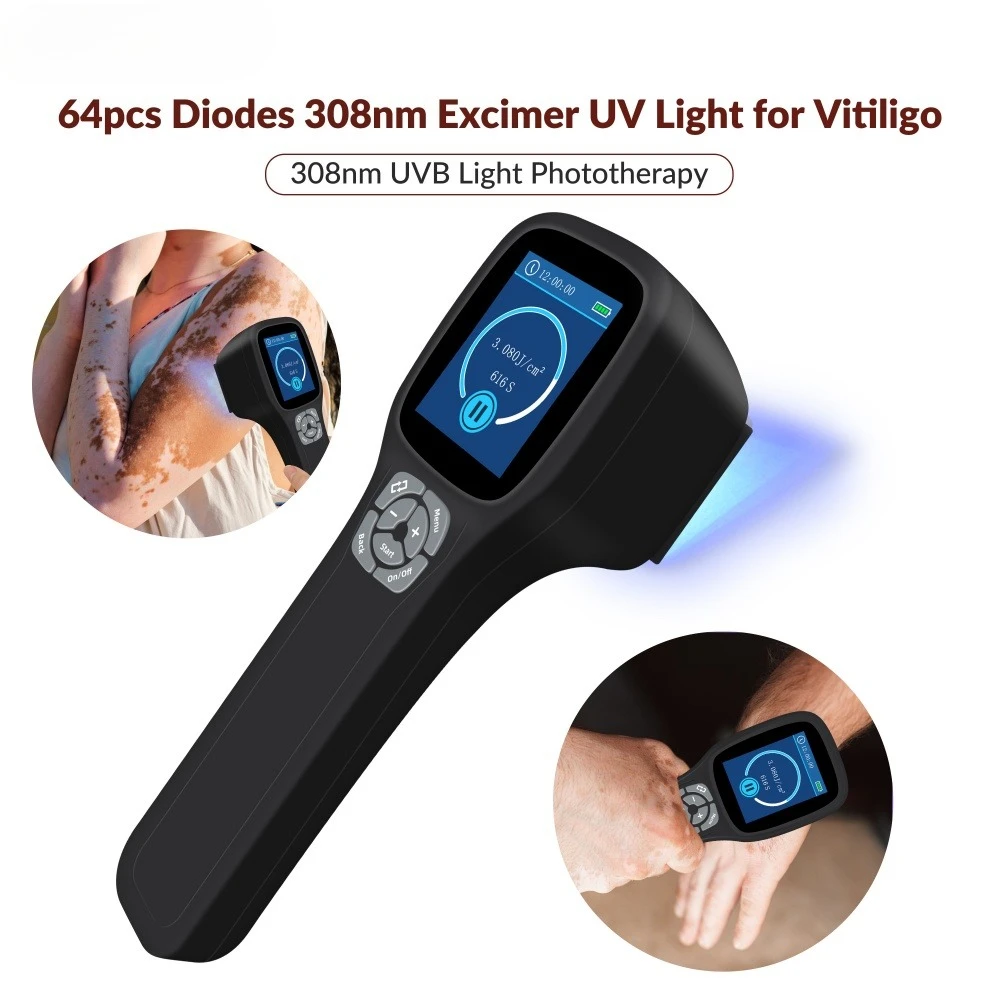 Portable 308nm UVB Light Therapy Machine 64 Diodes Handheld Phototherapy Lamp for Vitiligo Psoriasis Eczema Skin Treatment
Portable 308nm UVB Light Therapy Machine 64 Diodes Handheld Phototherapy Lamp for Vitiligo Psoriasis Eczema Skin Treatment