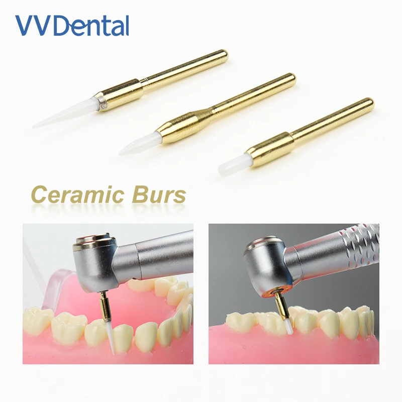 VVDental 1Pc Dental Ceramic Soft Tissue Burs Gingiva Trimmer Implant Cutting Surgical Ceramic Tooth Cleaning Implant Tip Tool
VVDental 1Pc Dental Ceramic Soft Tissue Burs Gingiva Trimmer Implant Cutting Surgical Ceramic Tooth Cleaning Implant Tip Tool