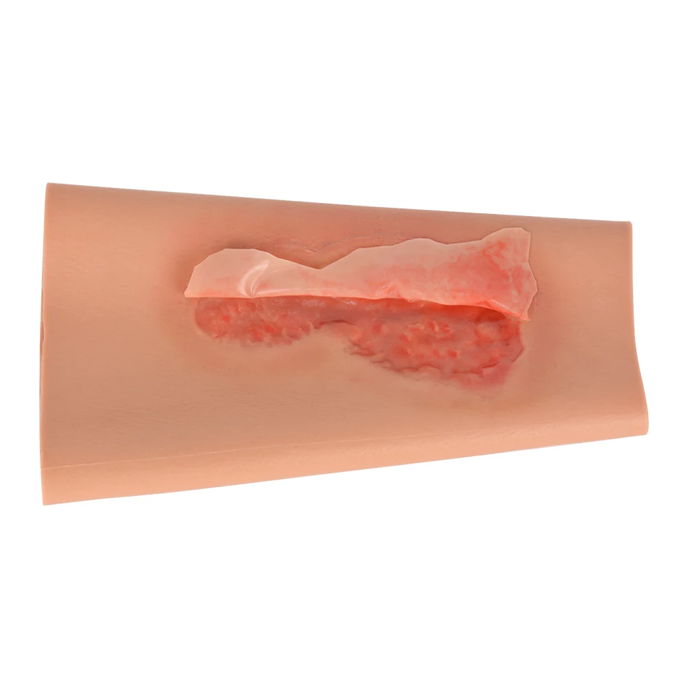 The Wearable Abrasion Wound Sleeve, Abrasion Wound Cuff Model, Silicon Model 
The Wearable Abrasion Wound Sleeve, Abrasion Wound Cuff Model, Silicon Model