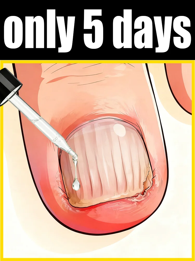 Wave goodbye to dull, ridged nails and cultivate smooth, shiny ones.
Wave goodbye to dull, ridged nails and cultivate smooth, shiny ones.