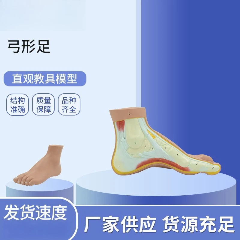 PNT-0727 Arcuate foot, model, foot pathology model, human foot anatomy model, foot joint
PNT-0727 Arcuate foot, model, foot pathology model, human foot anatomy model, foot joint