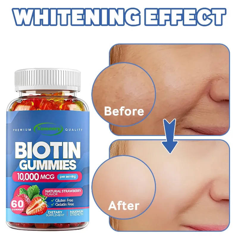 Биотинные жевательные жевательные конфеты для волос, ногтей, здоровье, осветляет кожу, способствует энергетического метаболизма и нервной системы, биотиновая добавка для мужчин и женщин
Биотинные жевательные жевательные конфеты для волос, ногтей, здоровье, осветляет кожу, способствует энергетического метаболизма и нервной системы, биотиновая добавка для мужчин и женщин
