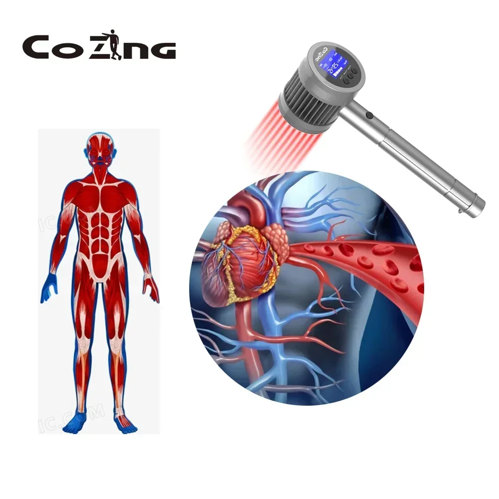 LLLTLaser терапевтическое устройство, шейный остеоартрит, ревматический артрит, пяточные шпоры, облегчение боли, оборудование для физиотерапии красного света
LLLTLaser терапевтическое устройство, шейный остеоартрит, ревматический артрит, пяточные шпоры, облегчение боли, оборудование для физиотерапии красного света