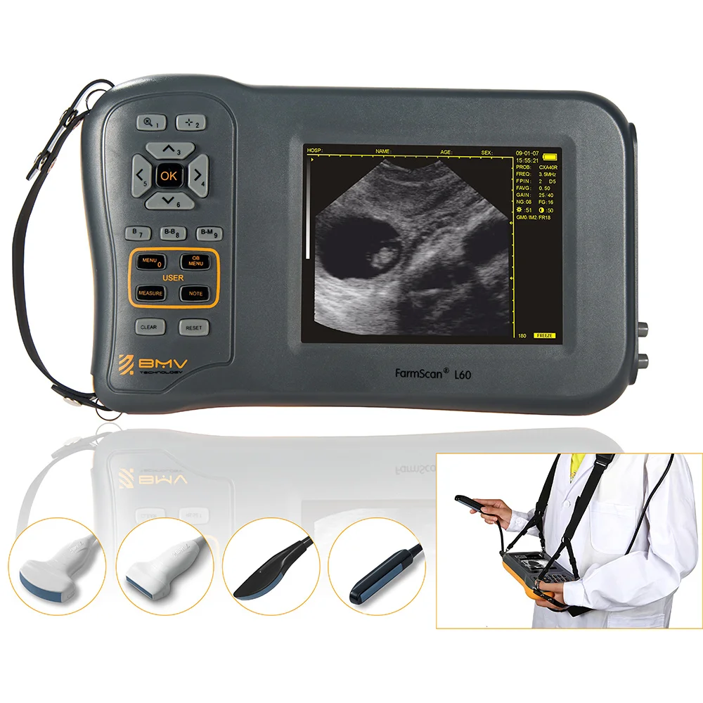 Hot Selling Handheld FarmScan L60 Portable Professional Pregnancy Testing Veterinary Ultrasound Scanner Cheap Price
Hot Selling Handheld FarmScan L60 Portable Professional Pregnancy Testing Veterinary Ultrasound Scanner Cheap Price