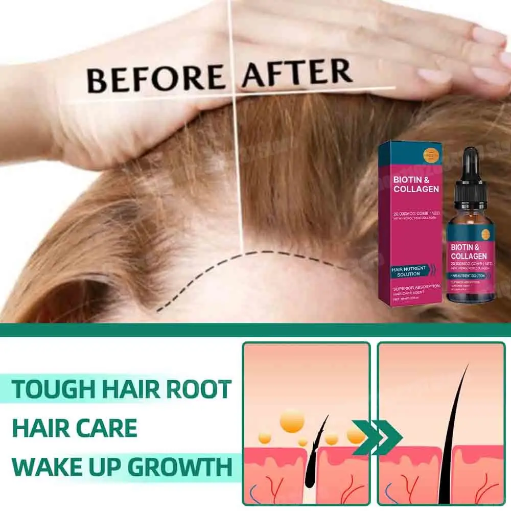 The most effective hair growth essential oil in 2025. Experts authoritatively certified,effective in repairing baldness and hair
The most effective hair growth essential oil in 2025. Experts authoritatively certified,effective in repairing baldness and hair