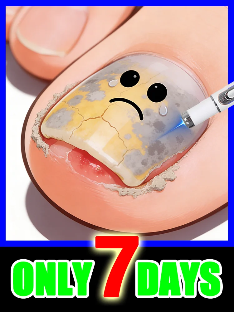 Fungi can not only erode your nail bed,ᵇᵘᵗ ᶜᵃⁿ ᵃˡˢᵒ ᵇᵉ ᵗʳᵃⁿˢᵐⁱᵗᵗᵉᵈ ᵗᵒ ʸᵒᵘʳ ᶠᵃᵐⁱˡʸfreeshipping
Fungi can not only erode your nail bed,ᵇᵘᵗ ᶜᵃⁿ ᵃˡˢᵒ ᵇᵉ ᵗʳᵃⁿˢᵐⁱᵗᵗᵉᵈ ᵗᵒ ʸᵒᵘʳ ᶠᵃᵐⁱˡʸfreeshipping