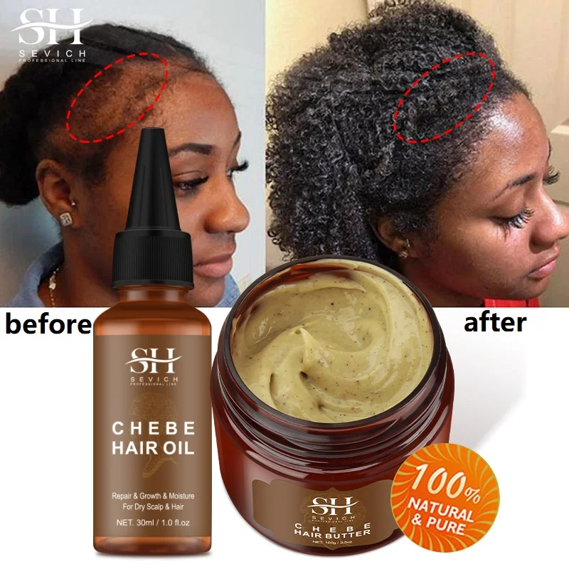 Fast Hair Growth Set Chebe Oil Traction Alopecia Hair Mask Anti Break Loss Original Africa Baldness Treatment Hair Care Products
Fast Hair Growth Set Chebe Oil Traction Alopecia Hair Mask Anti Break Loss Original Africa Baldness Treatment Hair Care Products