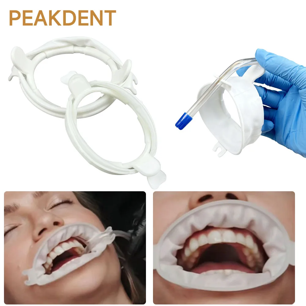 Rubber Dam Mouth Opener Dental Oral Opening Device Rubber Pad Dental Cheek Retractor O-Shaped Oral Hygiene Dental Material
Rubber Dam Mouth Opener Dental Oral Opening Device Rubber Pad Dental Cheek Retractor O-Shaped Oral Hygiene Dental Material
