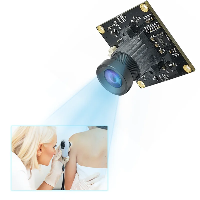 Wide Angle CMOS Sensor 5MP USB OV5640 Camera Module Skin Detection HFOV135 Image Sensor
Wide Angle CMOS Sensor 5MP USB OV5640 Camera Module Skin Detection HFOV135 Image Sensor