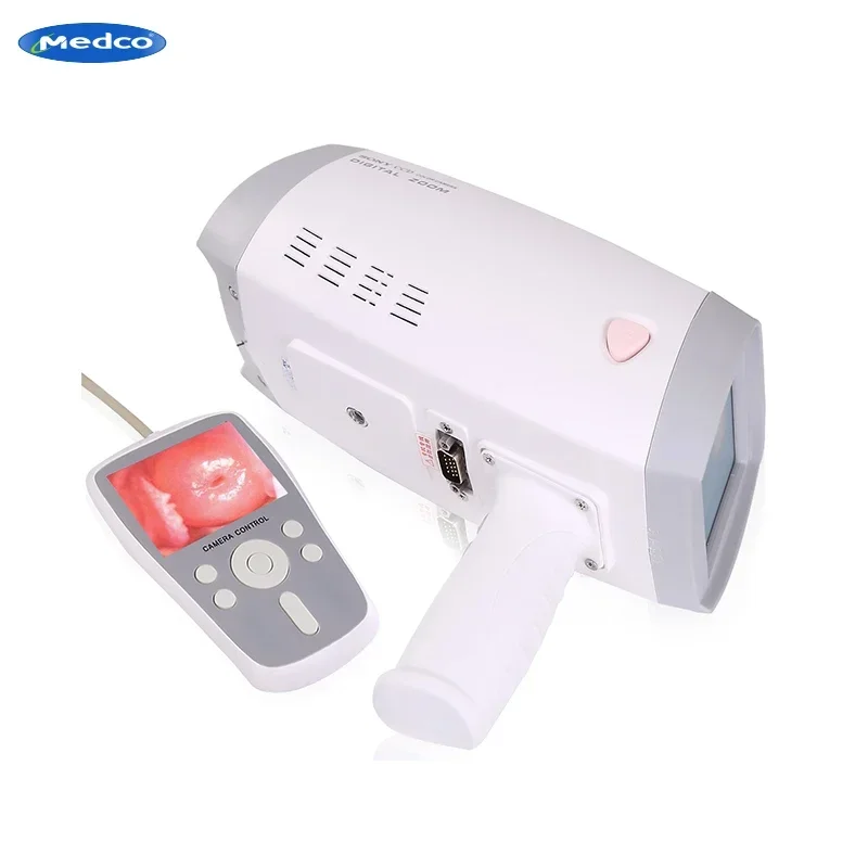 Portable Digital Colposcope Mini Gynecology Video Colposcope LED Video Display Electronic Colposcope
Portable Digital Colposcope Mini Gynecology Video Colposcope LED Video Display Electronic Colposcope