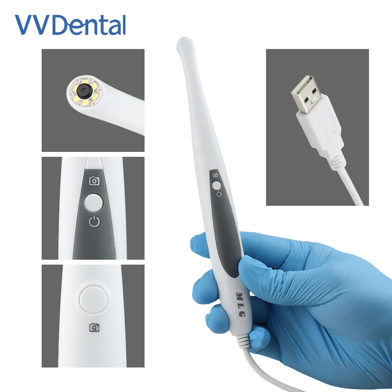 Интраоральная камера VVDental с проводным подключением, устройство для осмотра полости рта с автоматическим креплением, HD 1080P и 105 ° Широкоугольный эндоскоп для стоматологии
Интраоральная камера VVDental с проводным подключением, устройство для осмотра полости рта с автоматическим креплением, HD 1080P и 105 ° Широкоугольный эндоскоп для стоматологии