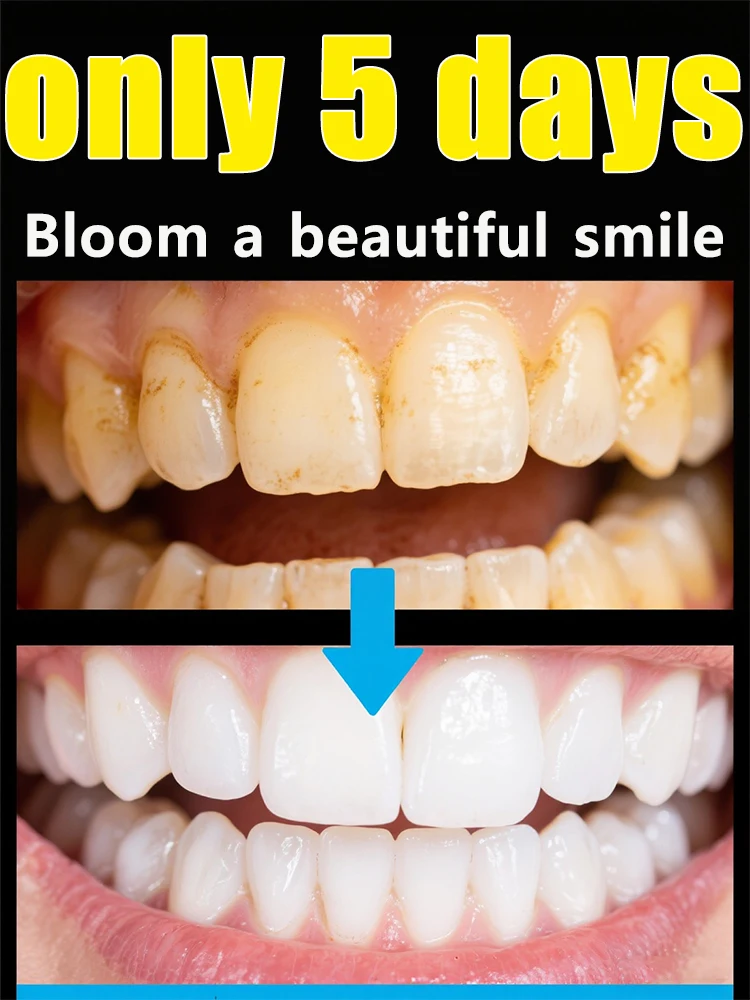 Bloom a beautiful smile, get a discount on the package 
Bloom a beautiful smile, get a discount on the package