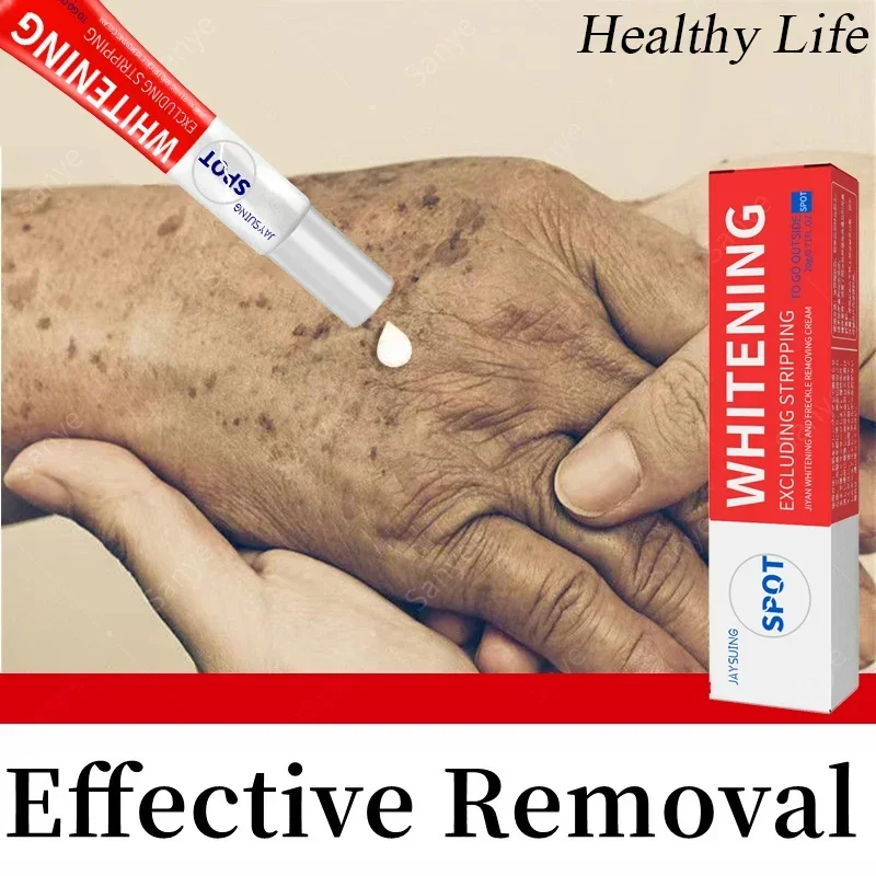 Powerful Whiten Freckles Cream Women Fast Remove Melasma Cream Fade Dark Spots Melanin Improve Dullness Brighten Serum Skin Care
Powerful Whiten Freckles Cream Women Fast Remove Melasma Cream Fade Dark Spots Melanin Improve Dullness Brighten Serum Skin Care