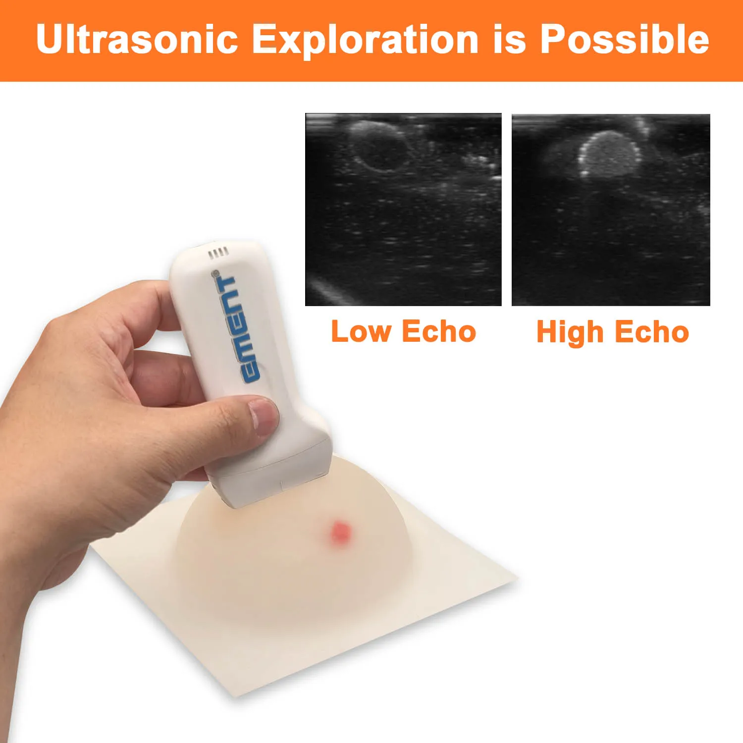 ultrasound guided breast model biopsy training tumor ultrasound scan and tylectomy education
ultrasound guided breast model biopsy training tumor ultrasound scan and tylectomy education